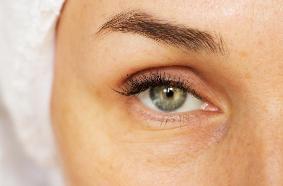 Erasing Wrinkles Using Dermal Fillers