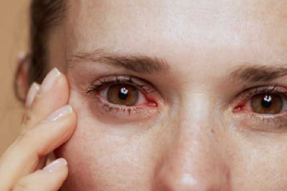 Online Prescription for Pink Eye in Just Minutes