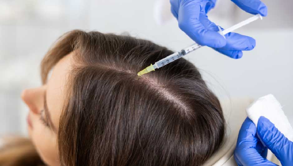 PRP Hair Loss Treatments Explained: Benefits, Safety, and What Women Can Expect